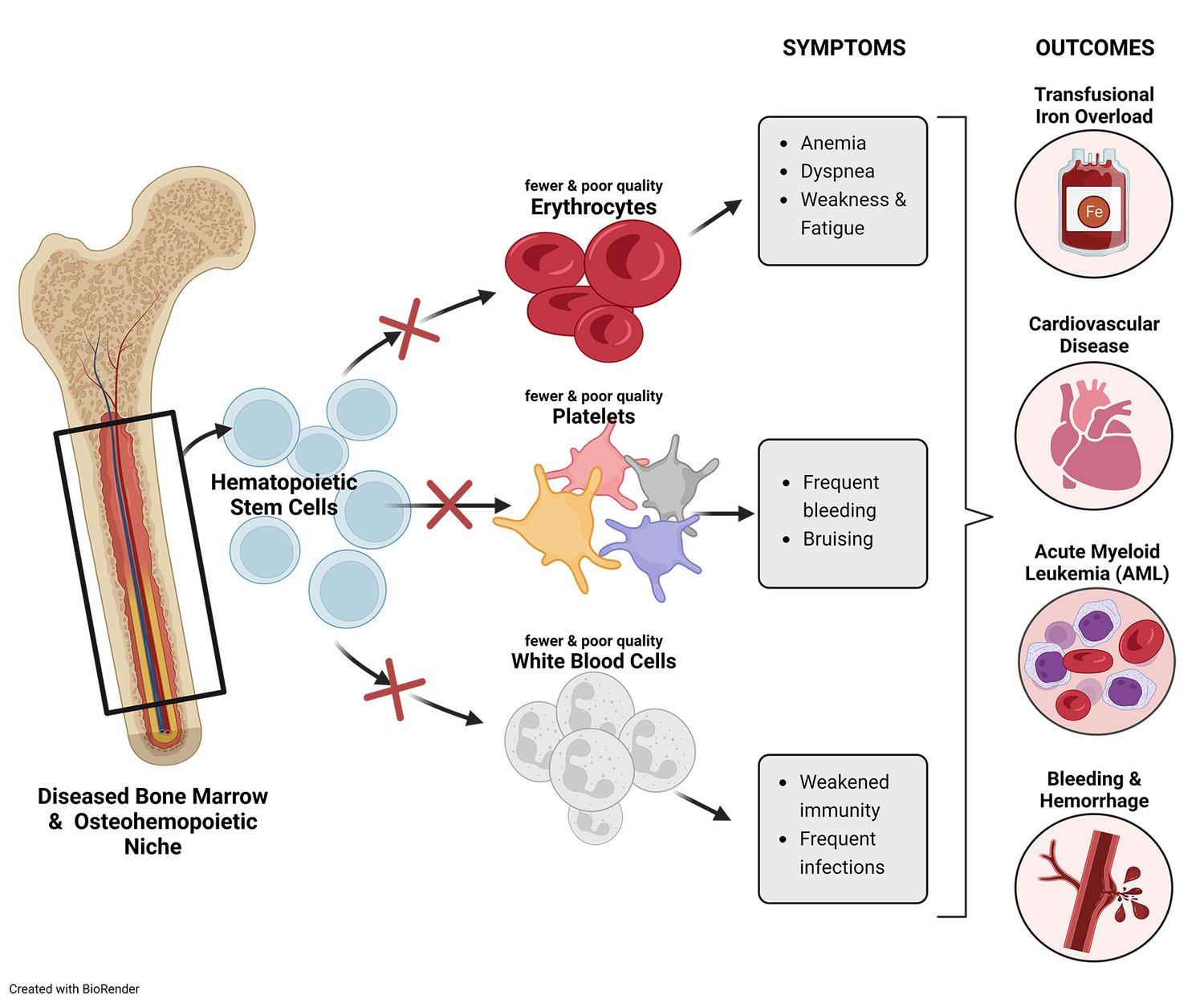 Diseased Bone Marrow & Osteohemopoietic Niche diagram
